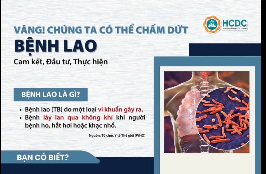 Ngày Thế giới Phòng chống Lao năm 2025: Vâng! Chúng ta có thể chấm dứt bệnh lao: Cam kết, Đầu tư, Thực hiện