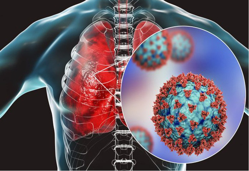 Nguy cơ bệnh tiến triển nặng khi đồng nhiễm COVID-19 và cúm