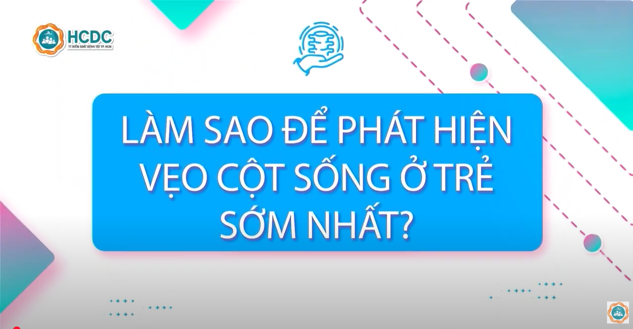 HCDC | Làm sao để phát hiện vẹo cột sống ở trẻ sớm nhất?