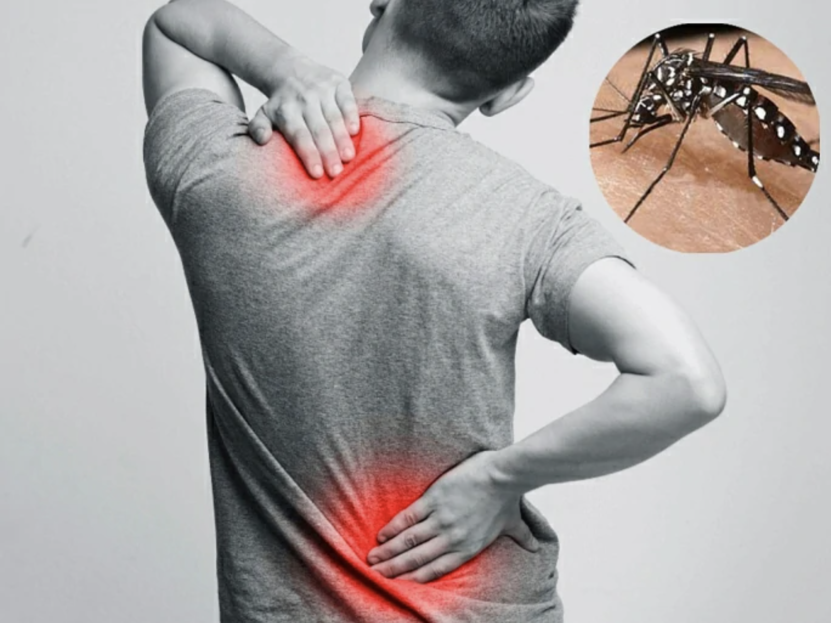 PHÂN BIỆT BỆNH CHIKUNGUNYA VÀ BỆNH SỐT XUẤT HUYẾT