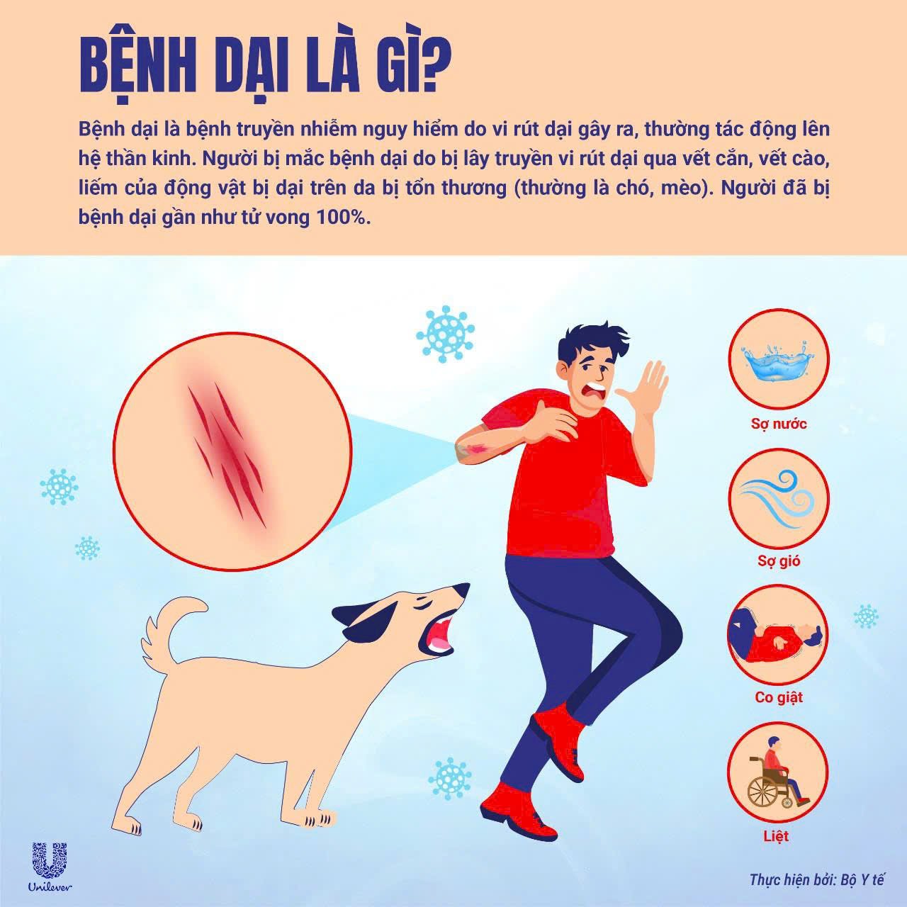 Bệnh dại - căn bệnh nguy hiểm nhưng có thể phòng ngừa