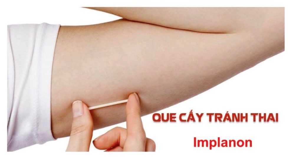 HƯỞNG ỨNG NGÀY TRÁNH THAI THẾ GIỚI (26/09/2025) “KHÔNG MANG THAI Ở TUỔI CHƯA THÀNH NIÊN – VÌ TƯƠNG LAI,  HẠNH PHÚC CỦA CHÍNH BẠN”