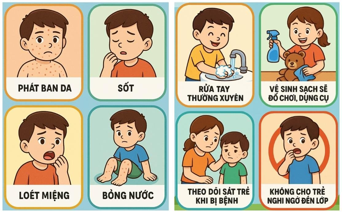 Sở Y tế TP.HCM cảnh báo tác nhân EV71 xuất hiện trở lại