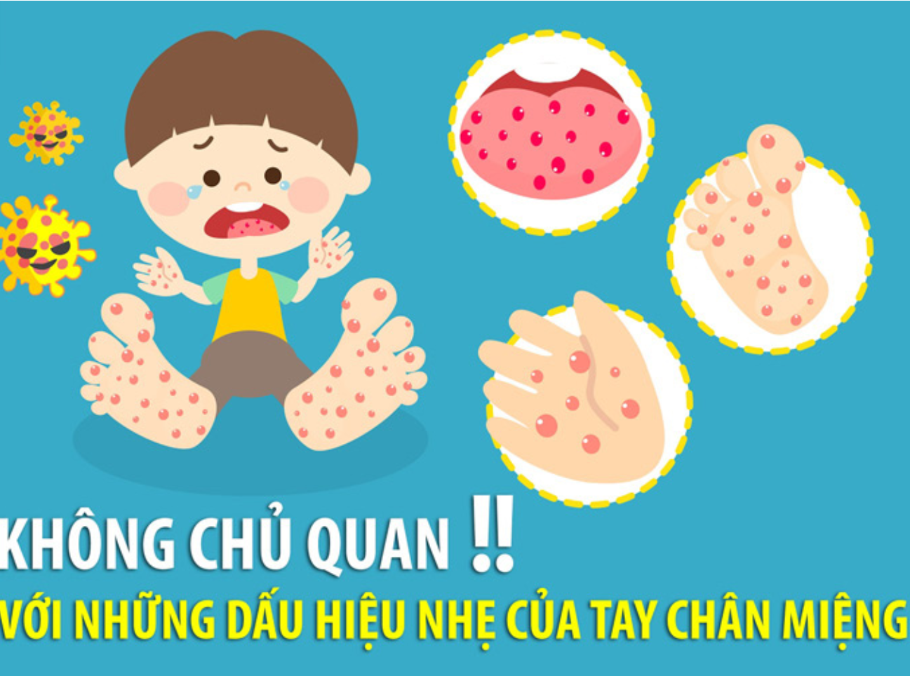 DẤU HIỆU NHẬN BIẾT VÀ CÁC DẤU HIỆU CẢNH BÁO BỆNH TRỞ NẶNG