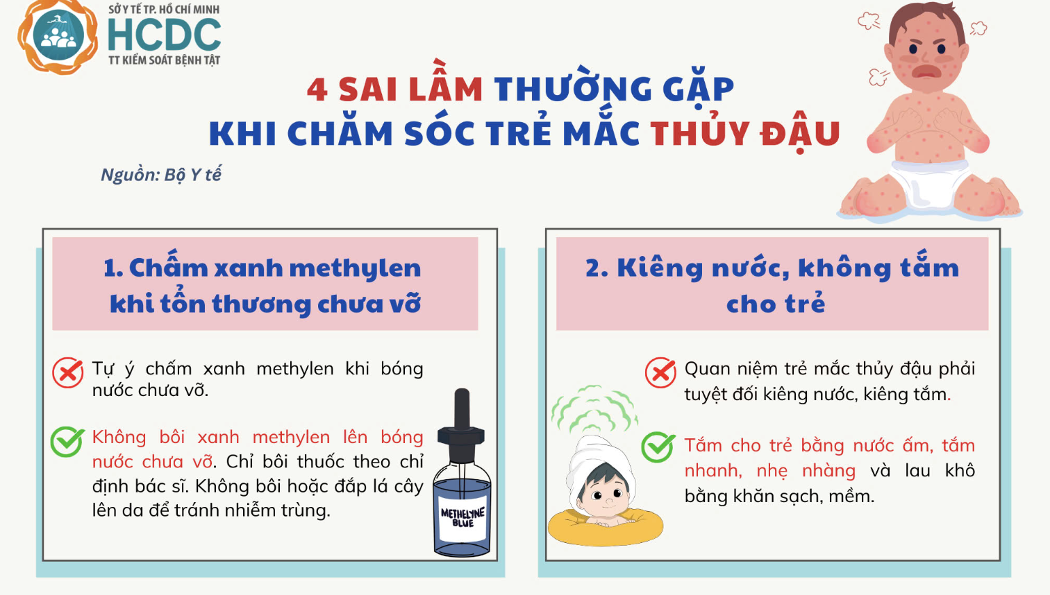 Bạn có chắc mình đang chăm trẻ mắc thủy đậu đúng cách?