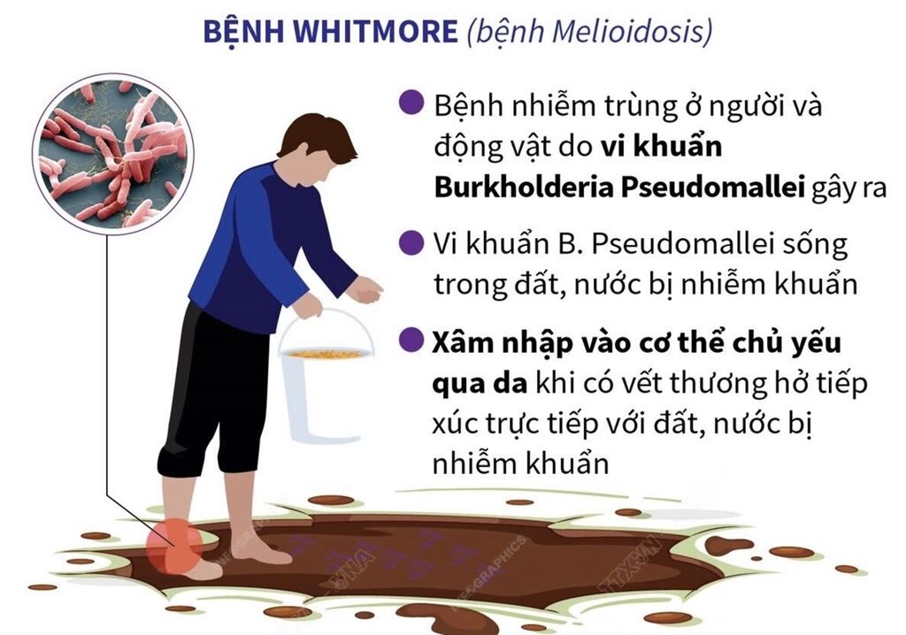 KHUYẾN CÁO PHÒNG, CHỐNG BỆNH WHITMORE