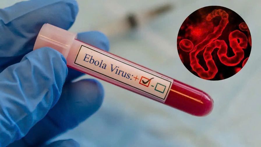 Sở Y tế TP.HCM: Chủ động giám sát, ngăn chặn nguy cơ xâm nhập của dịch bệnh Ebola