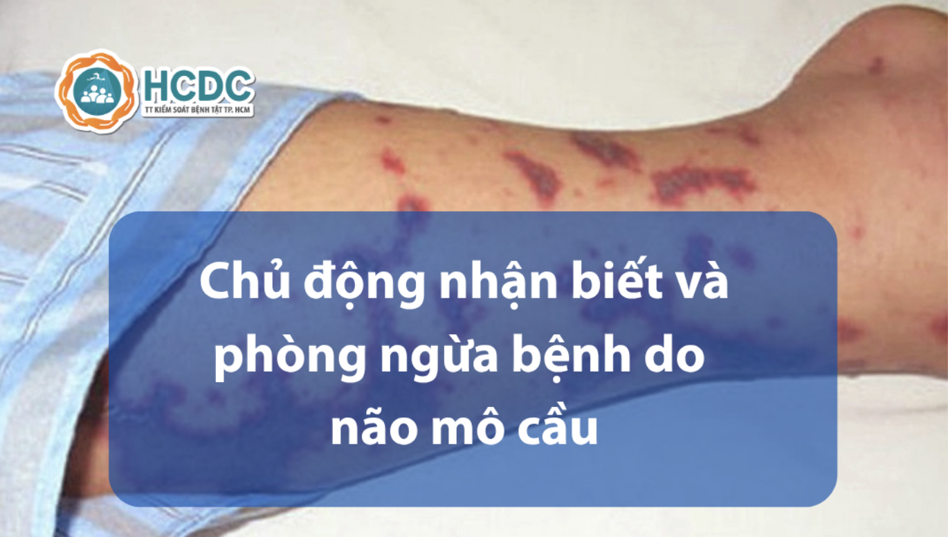 Chủ động nhận biết và phòng ngừa bệnh do não mô cầu