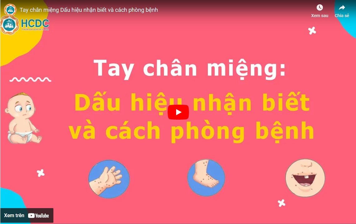 Tay chân miệng Dấu hiệu nhận biết và cách phòng bệnh