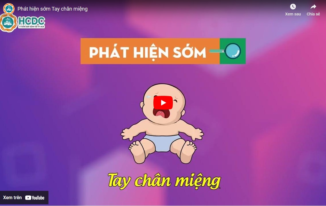 Phát hiện sớm Tay chân miệng