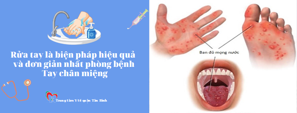 Hỏi và đáp về bệnh Tay chân miệng