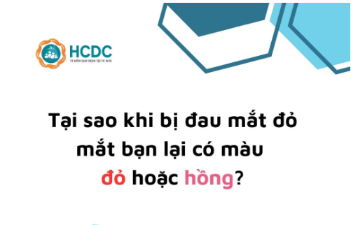 Hỏi đáp về bệnh đau mắt đỏ
