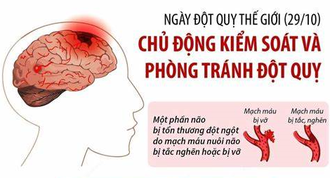Ngày đột quỵ thế giới – World stroke day 29/10/2023