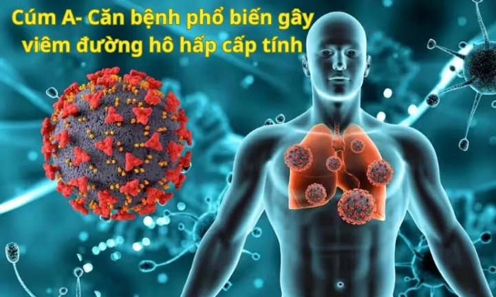 Triệu chứng nhiễm cúm A/H5N1 và các giai đoạn tiến triển của bệnh