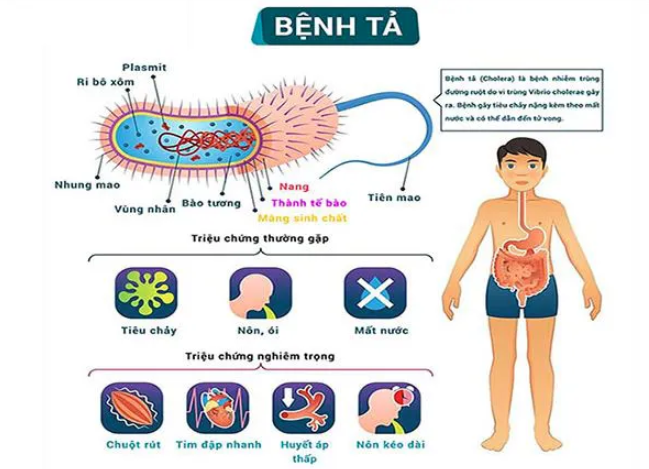 Bệnh tả: Nguyên nhân, triệu chứng, lây truyền, cách điều trị và phòng bệnh