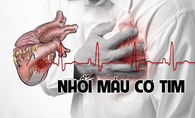 2 tư thế ngồi nguy hiểm có thể gây nhồi máu cơ tim