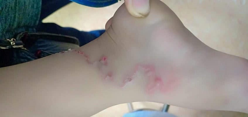 NHIỄM BỆNH TỪ THÚ CƯNG: BÁC SĨ KHUYẾN CÁO NGƯỜI NUÔI CÁCH PHÒNG TRÁNH LÂY BỆNH