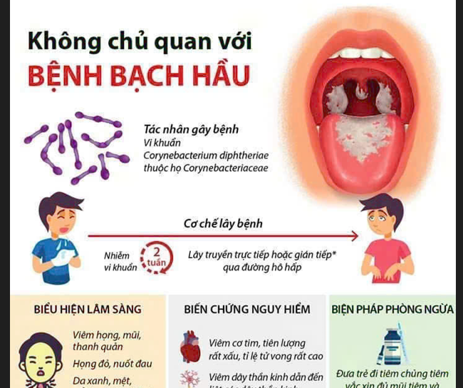 Không chủ quan với bệnh bạch hầu
